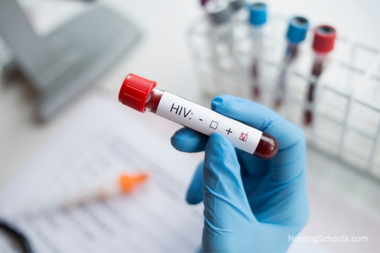AIDS Nurse holding a test tube containing blood marked as HIV positive.