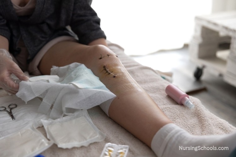 Orthopedic Nurse provides wound care, manages casts and splints, and educates patients and families on post-surgical care.