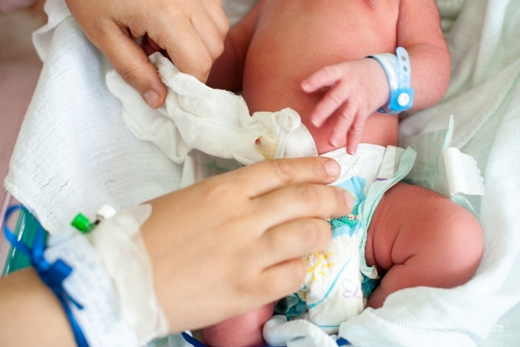 Postpartum Nurse watches a new mother change their newborn baby's diaper.